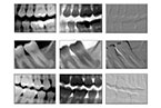 Radiografia Digitale - Dott. Andrea Ronconi